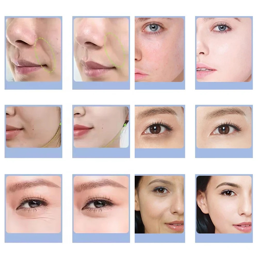 7 Types Facial CO2 Oxygen Bubb - Spa Y Wellness ulasan dan harga